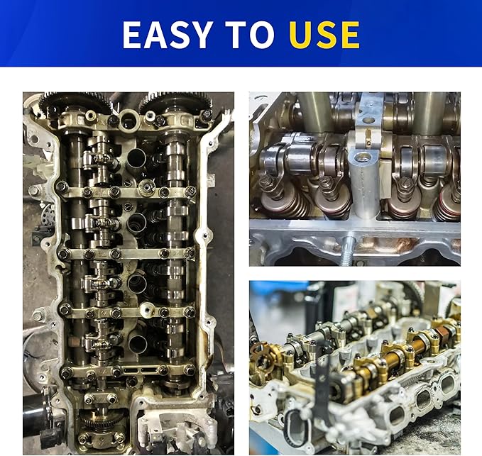 17PCS Engine Timing Tool Kit with Fuel Injector Remover Installer Tool, Compatible with Mercedes Benz M133 M264 M270 M274, Camshaft Locking Alignment Timing Tools Set