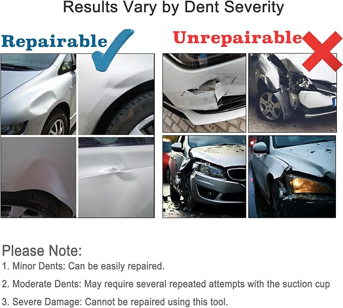 Dent Puller Kit for Car, 3-Pack Paintless Car Dent Repair Remover Kit, Dent Removal Tool with Suction Cup for Auto Body Hood/Door, No Glue No Scratch