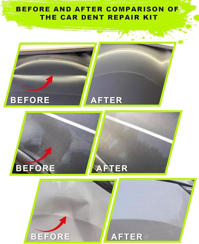 22pcs Car Dent Puller Kit,Paintless Dent Repair Kit for Dent Removal with Bridge Puller,Small Dent Remover Tool for Car Refrigerator Hail Damage Door DIY Repair