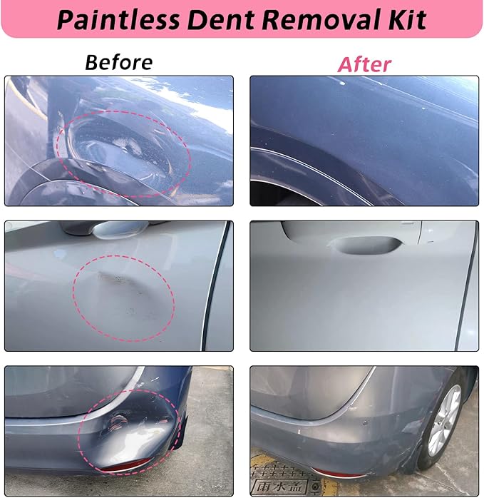 Car Dent Puller, 8 Packs Dent Remover Tool for Car Dent Repair, Versatile Suction Cups Puller with Strong Suction & Effortless Handle for Auto Body, Glass, Fridge, Tile Lifting & Objects Moving