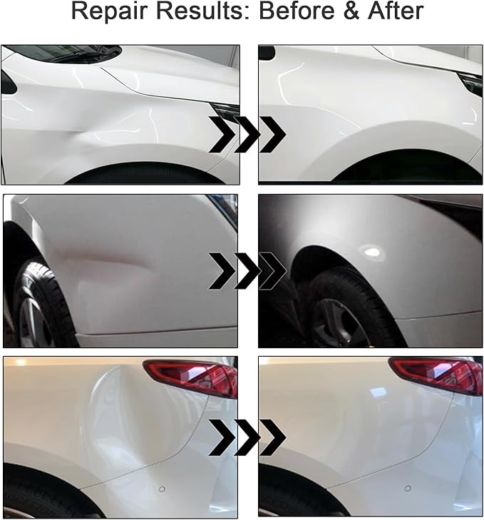 Dent Puller Kit for Car, 3-Pack Paintless Car Dent Repair Remover Kit, Dent Removal Tool with Suction Cup for Auto Body Hood/Door, No Glue No Scratch