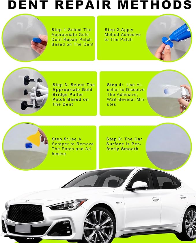 27pcs Dent Puller Kit,Paintless Dent Repair Kit for Dent Removal with Bridge Puller, Dent Removal Kit,Dent Remover Tool for Car Refrigerator Hail Damage Door Ding Repair
