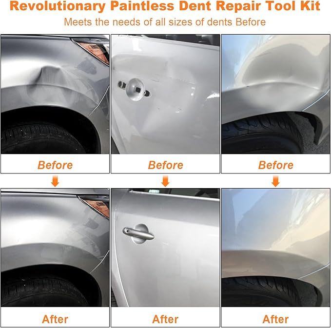 97pcs Dent Puller Kit, Paintless Dent Removal Kit for Dent Removal, Car Dent Puller with Golden Lifter, Bridge Puller, Slide Hammer T-Bar, Dent Remover Tool for Car Refrigerator Door Ding Repair