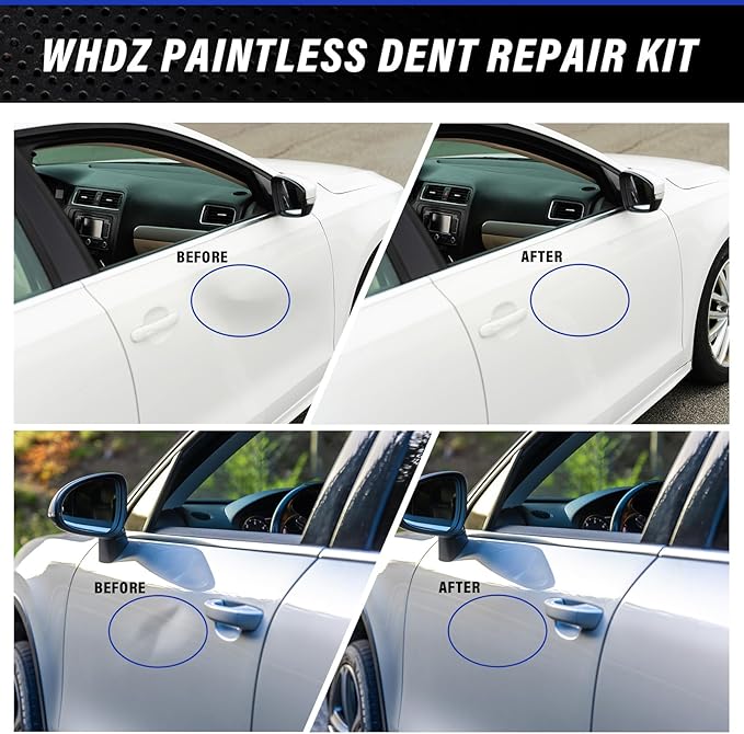 WHDZ Paintless Dent Repair Kit Dent Remover Tools with Dent Lifter Puller, Bridge Puller, 2 in 1 T-Bar Auto Dent Puller Kit for Door Ding Hail Damage