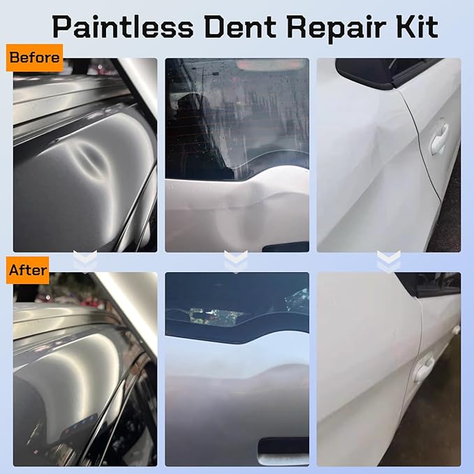 Paintless Dent Repair Kit, Car Dent Removal Tools with Adjustable Dent Lifter, Bridge Puller, Glue Gun & Tabs – Professional Auto Body Dent Puller Kit for Car, Hail & Door Dings
