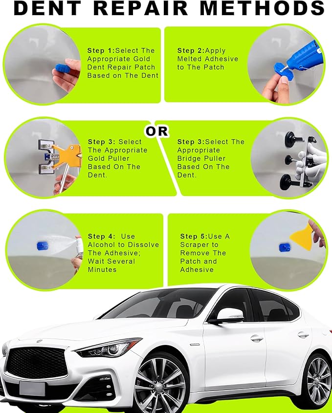 54pcs Dent Puller Kit,Car Dent Puller Kit,Paintless Dent Removal Kit,Dent Remover Tool For Car With Bridge Puller,Golden Lifter,Car Dent Repair Kit for Car Refrigerator Door Large & Small Dent Removal